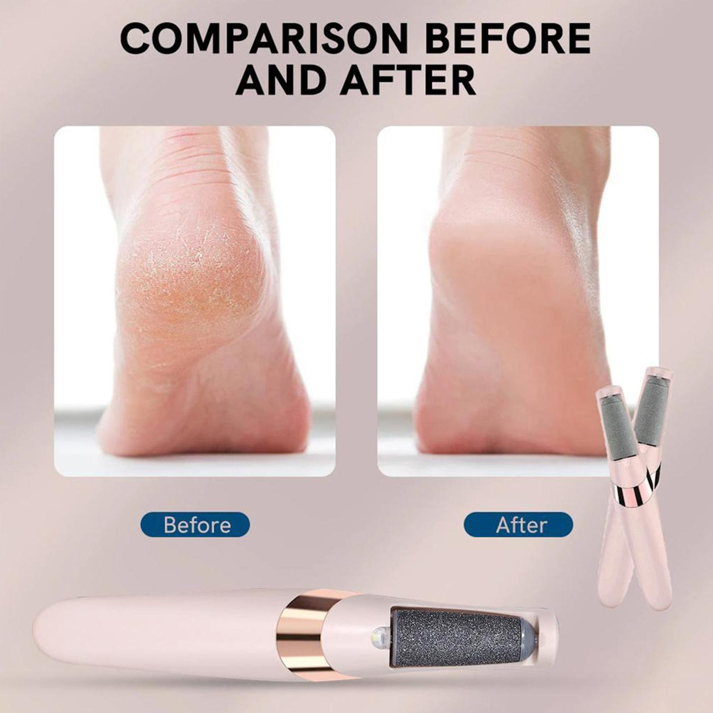 Rechargeable Electric Foot Callus Remover Pedicure Machine